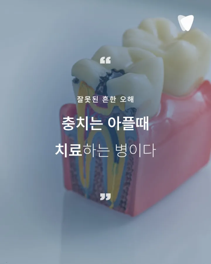 이미지 카드 · 아프지 않아서 미뤘던 그날, 치아는 이미 신호를 보내고 있었습니다