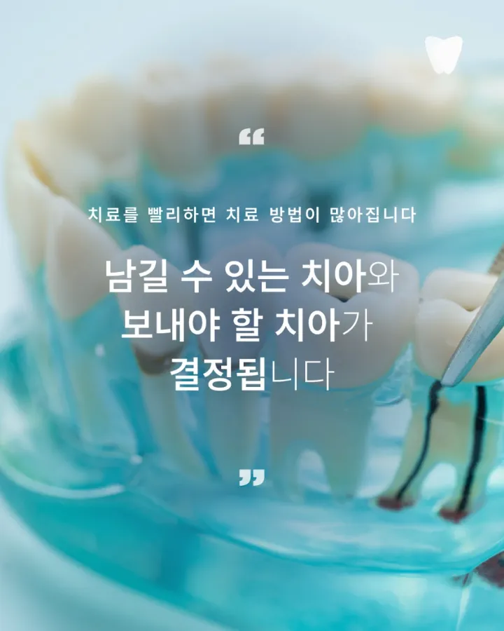 이미지 카드 · 아프지 않아서 미뤘던 그날, 치아는 이미 신호를 보내고 있었습니다