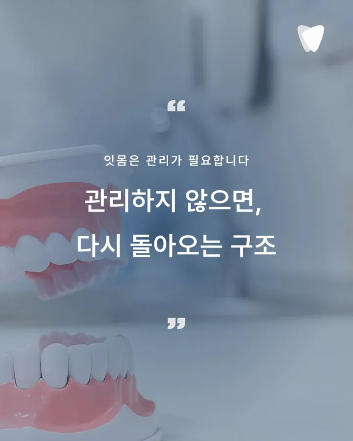 이미지 카드 · 잇몸병은 왜 재발할까? 치료보다 중요한 것, 잇몸을 오래 쓰는 설계