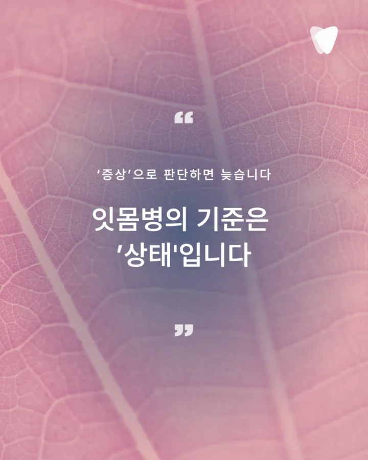 이미지 카드 · 잇몸병은 왜 재발할까? 치료보다 중요한 것, 잇몸을 오래 쓰는 설계