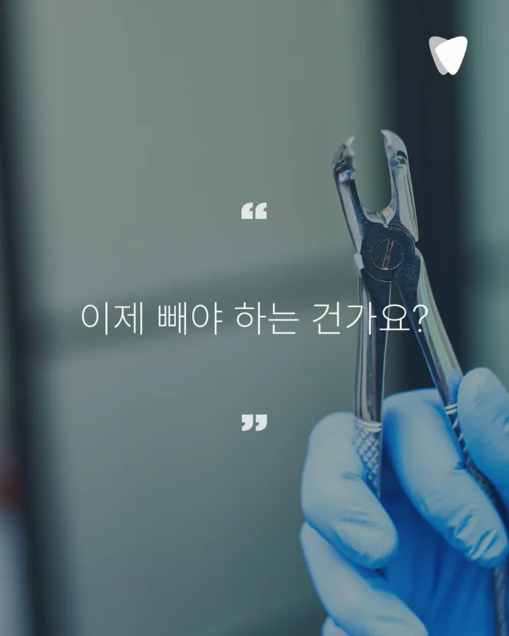 이미지 카드 · 오래 쓰는 선택, 임플란트를 늦추는 이유