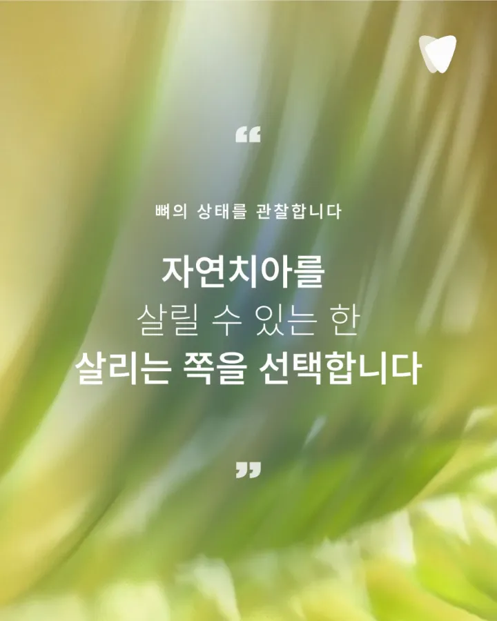 이미지 카드 · 오래 쓰는 선택, 임플란트를 늦추는 이유