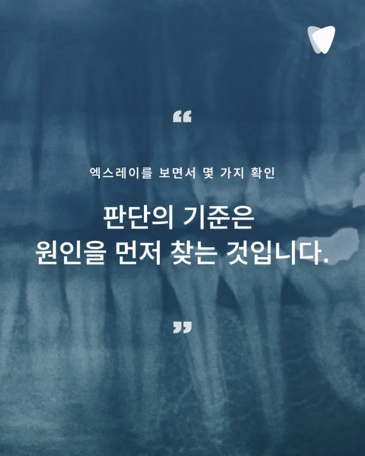 이미지 카드 · 치아가 조용히 말을 거는 방식 — 색이 바뀐다는 것의 의미
