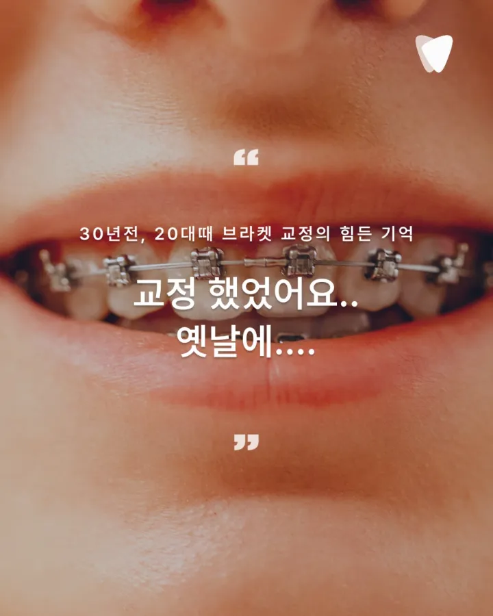 이미지 카드 · 30년을 참아온 미소, 1년 만에 회복하기
