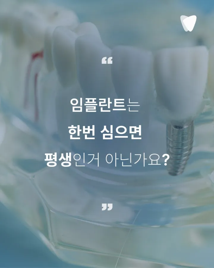 이미지 카드 · 운정 뿌리사랑치과 임플란트 철학 — 심는 날이 시작인 이유