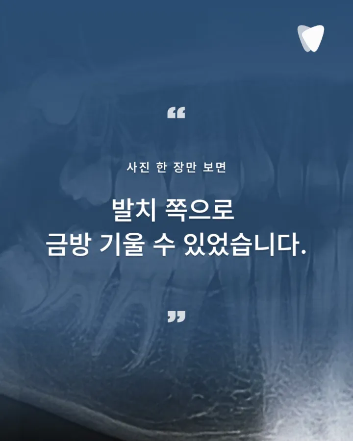 이미지 카드 · 발치 권유받은 치아, 정말 뽑아야 할까요? 자연치아 살리기의 판단 기준