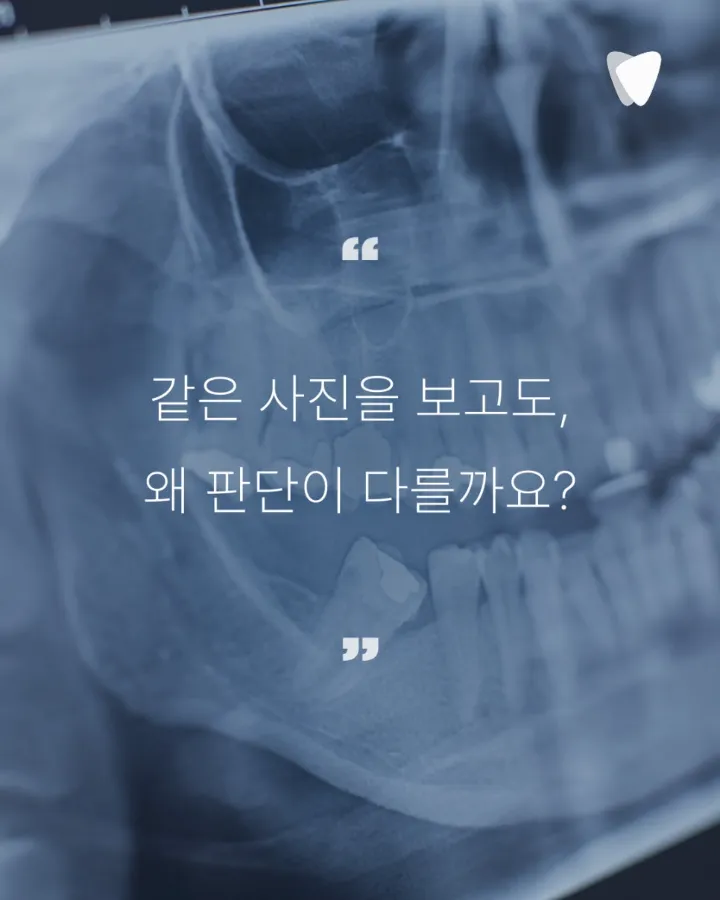 이미지 카드 · 임플란트 전 뼈가 부족하다는 진단, 정말 뼈이식이 꼭 필요할까?