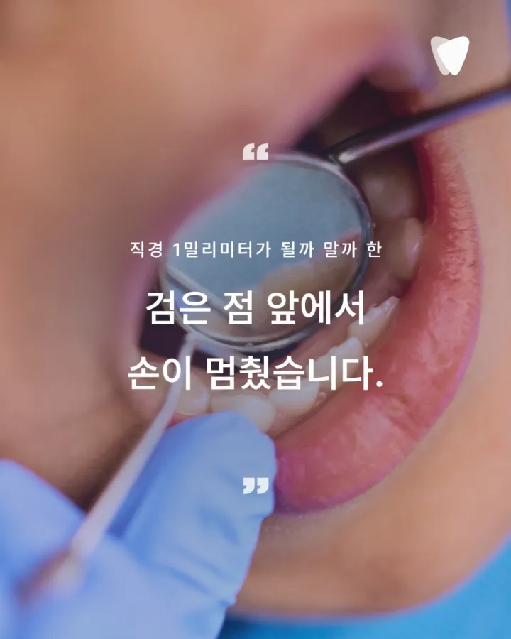 이미지 카드 · 초기 충치 레진 치료, 깎지 않고 지켜볼 수 있는 기준은 무엇인가