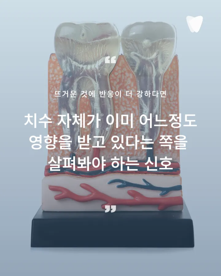 이미지 카드 · 뜨거운 음식에 시린 치아, 자극이 사라진 뒤에도 남는 불편함을 살피는 이유