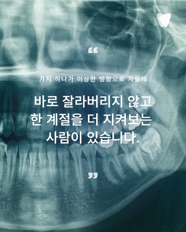 이미지 카드 · 사랑니 발치, 안 아프면 안 빼도 될까요? 판단 기준 정리