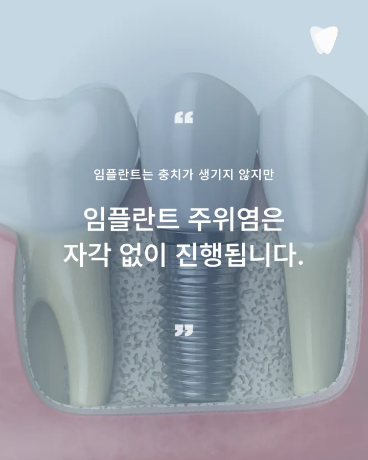 이미지 카드 · 임플란트 후 관리, 자연치아와 무엇이 다른가요 — 통증 없어도 확인해야 하는 이유