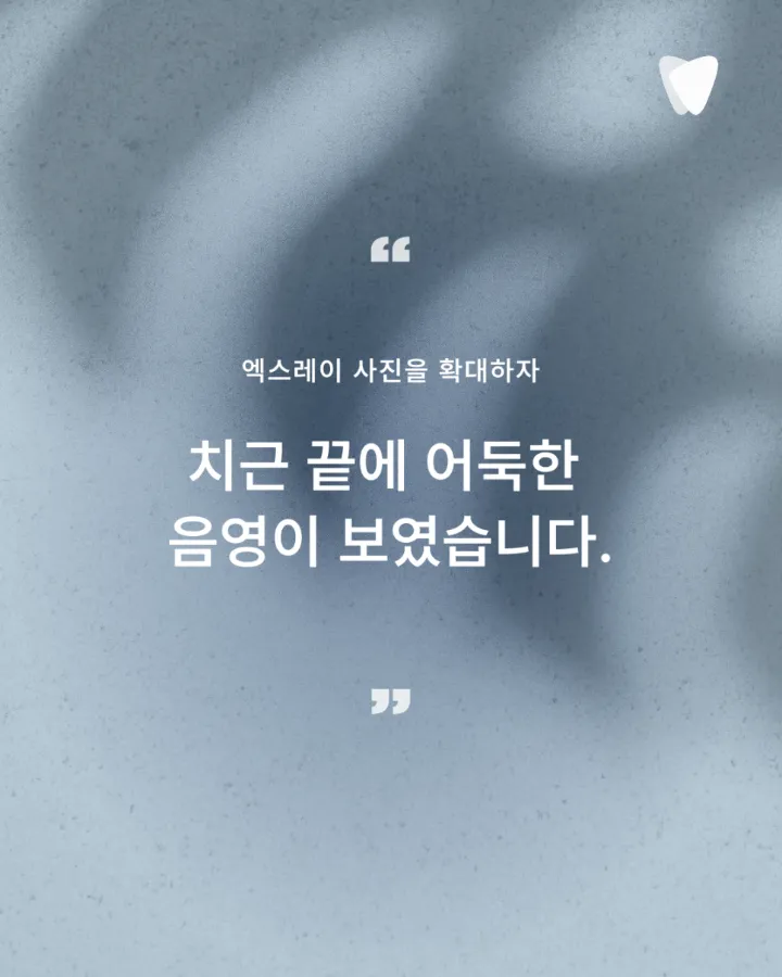 이미지 카드 · 열어야 할까, 두어야 할까 — 재신경치료를 결정하는 판단 앞에서