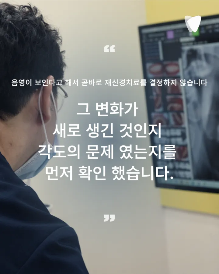이미지 카드 · 열어야 할까, 두어야 할까 — 재신경치료를 결정하는 판단 앞에서