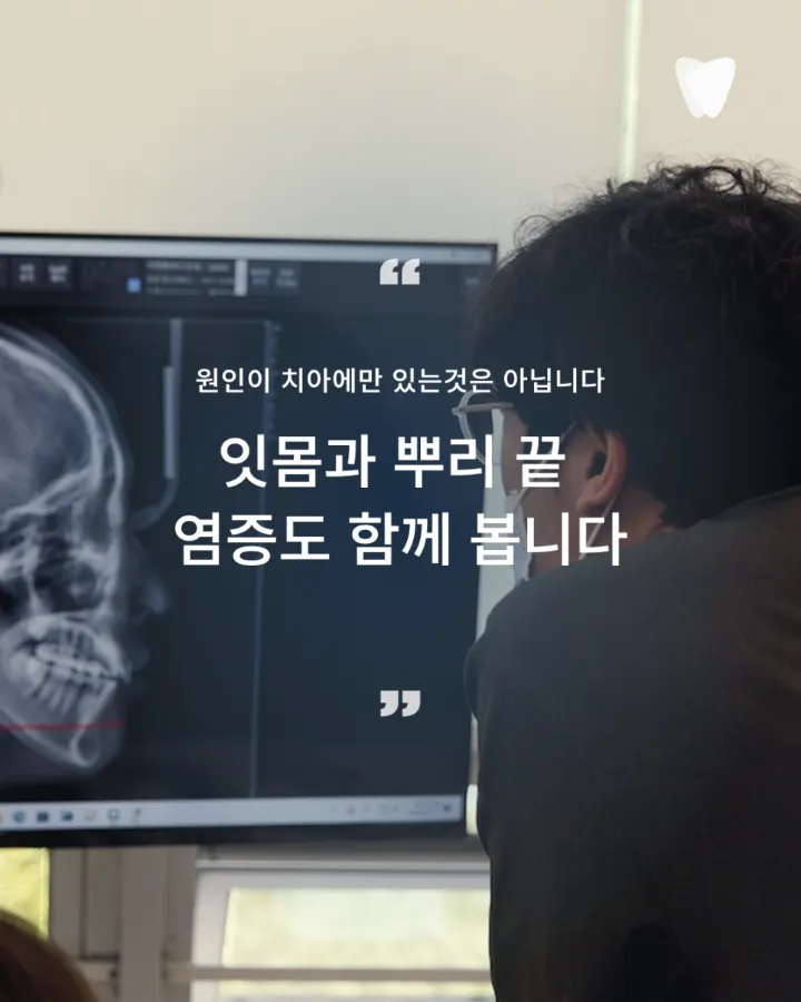 이미지 카드 · 어금니가 씹을 때 아픈 이유, 충치만 원인은 아닙니다