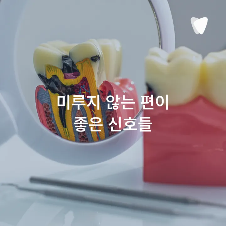 이미지 카드 · 신경치료 꼭 해야 하나요? 치아를 살리는 기준