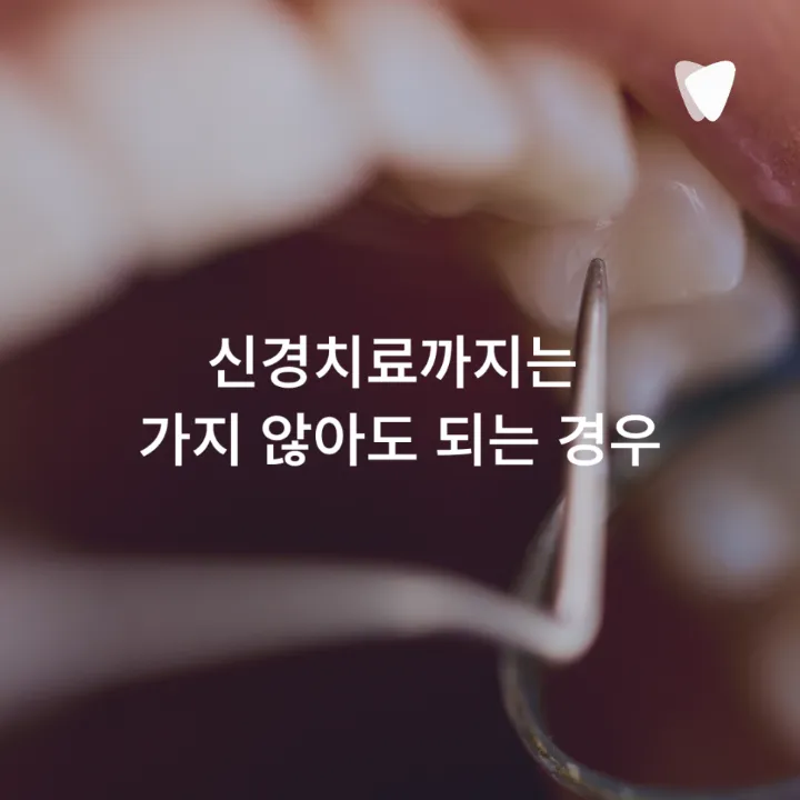 이미지 카드 · 신경치료 꼭 해야 하나요? 치아를 살리는 기준