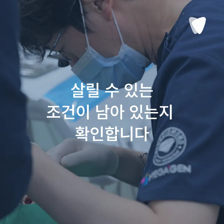 이미지 카드 · 운정 발치 고민 중이라면, 치아를 뽑기 전 한 번 더 확인해야 하는 이유