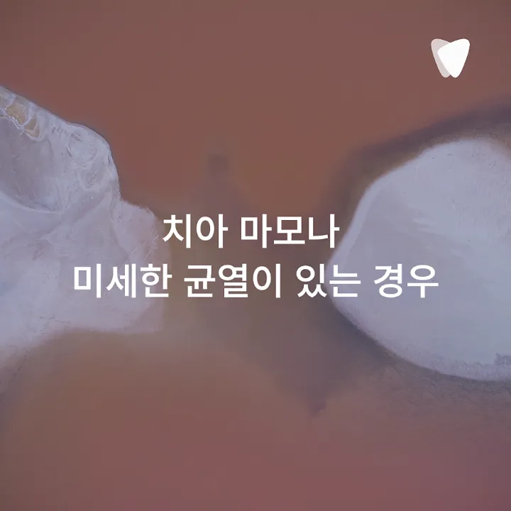 이미지 카드 · 찬물 마실 때 치아가 시린 이유, 충치 때문만은 아닙니다