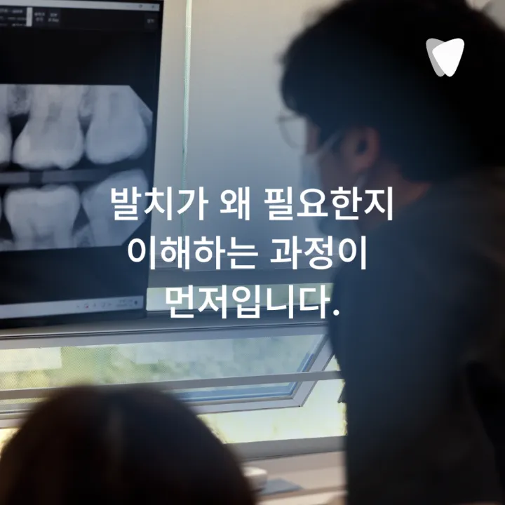 이미지 카드 · 운정 임플란트 상담 전, 자연치아를 먼저 확인하는 이유