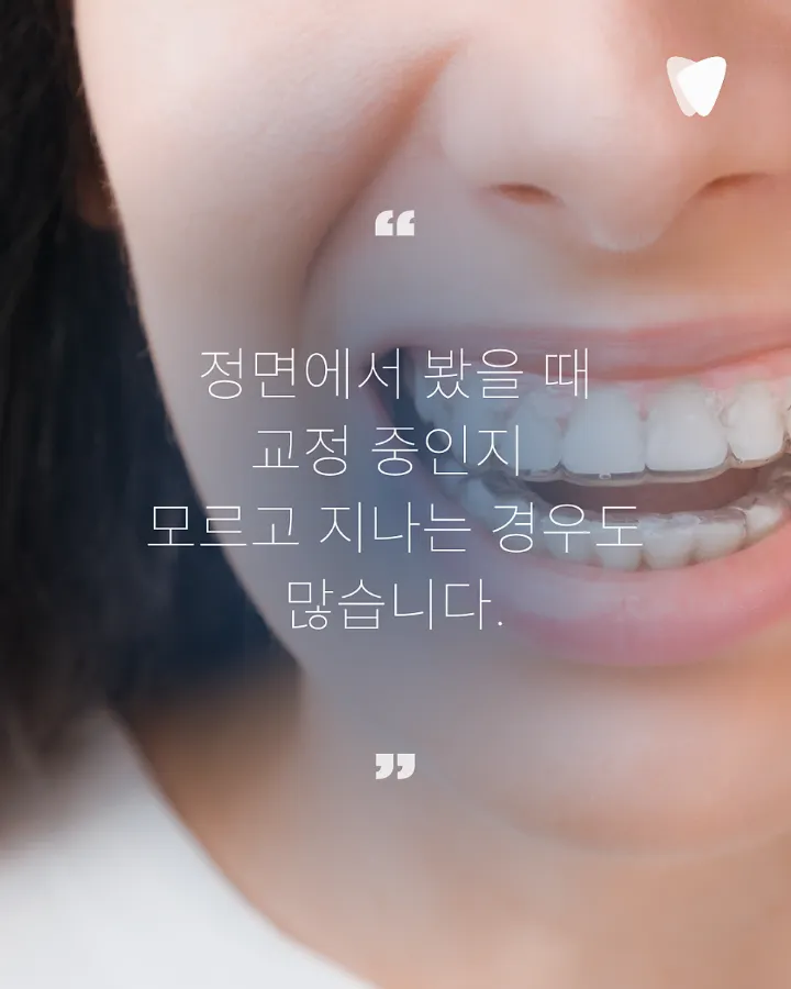이미지 카드 · 운정 투명교정, 티 덜 나는 교정을 찾는 분께