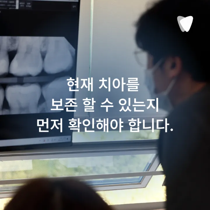 이미지 카드 · 운정 임플란트 비용, 숫자보다 먼저 확인해야 할 것
