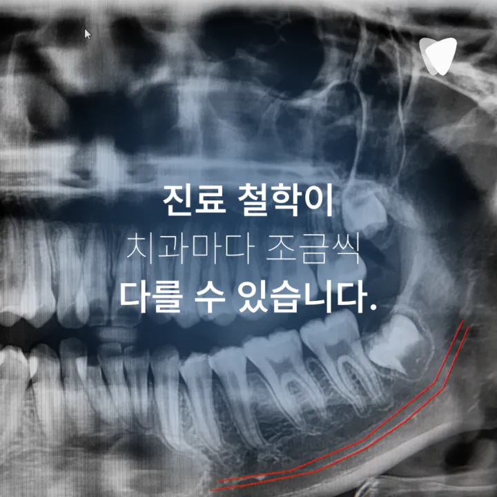 이미지 카드 · 치과마다 진단이 다르게 나오는 이유는 무엇일까요?