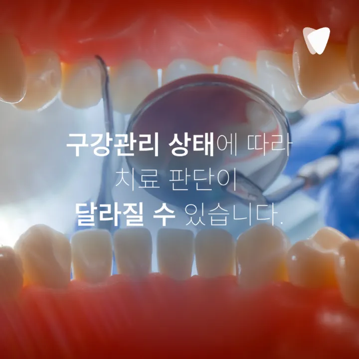 이미지 카드 · 치과마다 진단이 다르게 나오는 이유는 무엇일까요?