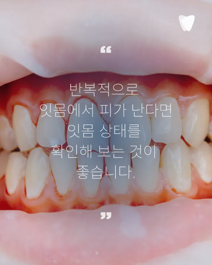 이미지 카드 · 양치할 때 잇몸에서 피가 나는 이유와 확인할 점