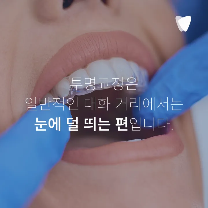 이미지 카드 · 교정 중에도 평소처럼 식사할 수 있다는 특별함