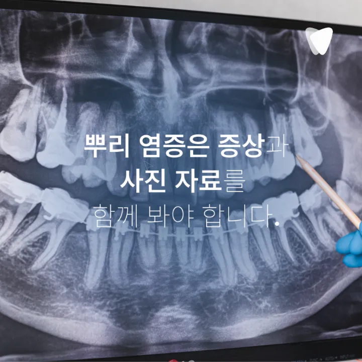 이미지 카드 · 신경치료 후에도 아픈 이유와 다시 봐야 할 부분