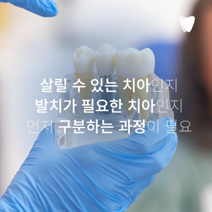 이미지 카드 · 파주 임플란트 치과, 재료와 관리 기준을 봐야 하는 이유