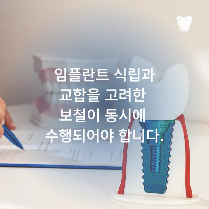이미지 카드 · 파주 임플란트 치과, 재료와 관리 기준을 봐야 하는 이유