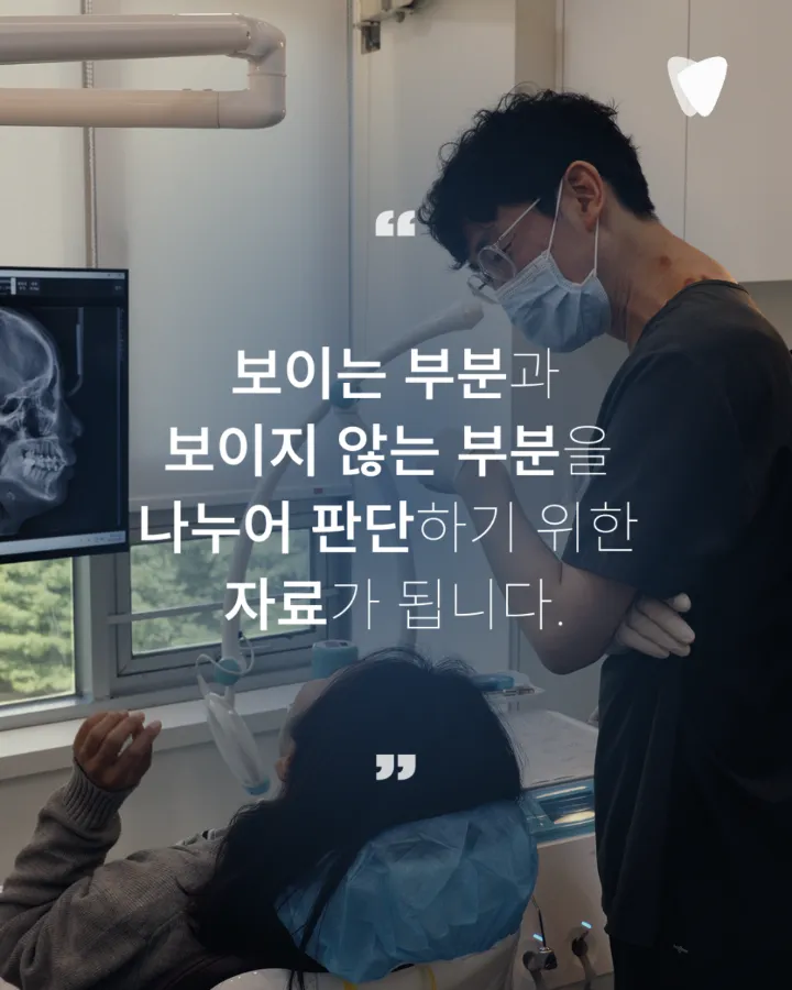 이미지 카드 · 치과 CT 꼭 찍어야 하나요? 사진·엑스레이를 찍는 이유