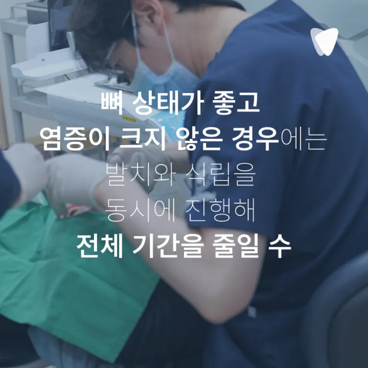 이미지 카드 · 임플란트 기간, 발치부터 보철까지 얼마나 걸릴까요?