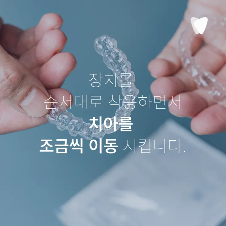 이미지 카드 · 투명교정 장점, 브라켓보다 편한 부분은 무엇일까요?