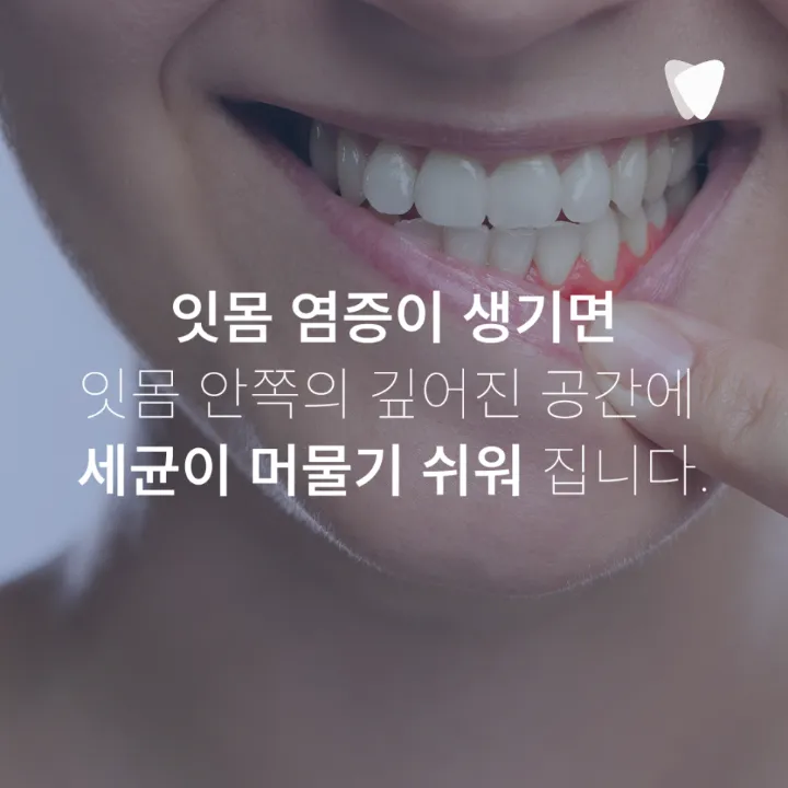 이미지 카드 · 양치해도 입냄새가 남는 이유, 치아와 잇몸에서 꼭 봐야 할 5가지