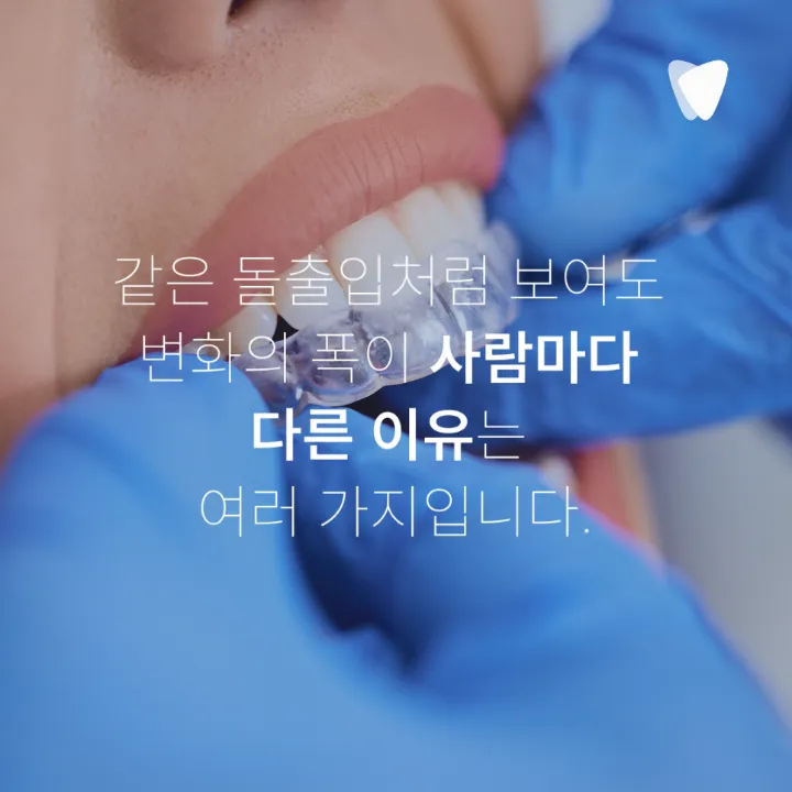 이미지 카드 · 돌출입 때문에 투명교정을 알아보고 계신가요?