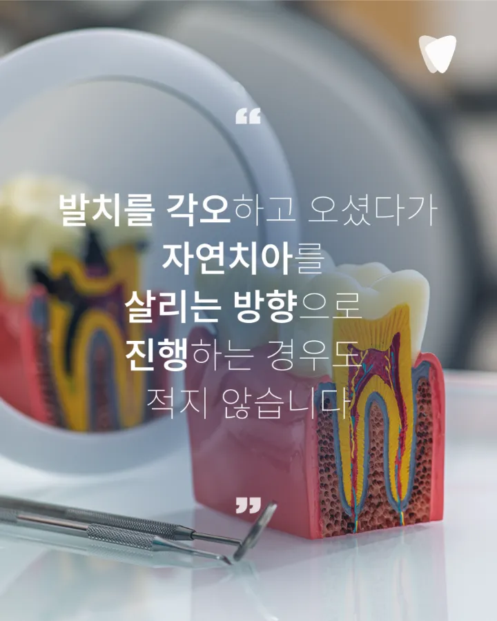 이미지 카드 · 충치가 깊어도 치아를 살릴 수 있는 경우