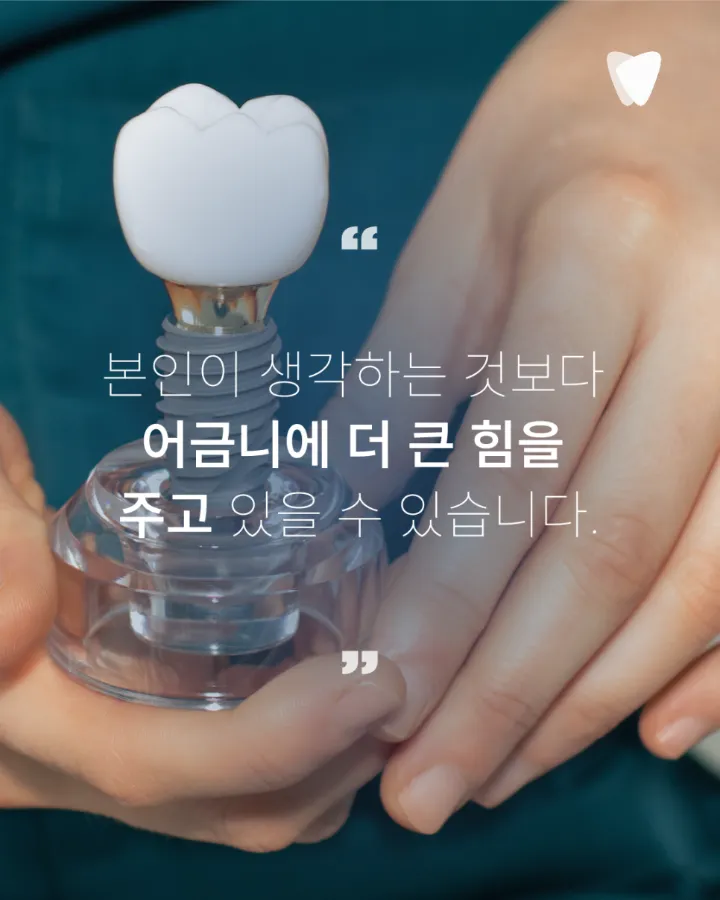 이미지 카드 · 운정 어금니 임플란트, 앞니 임플란트와 다른 점