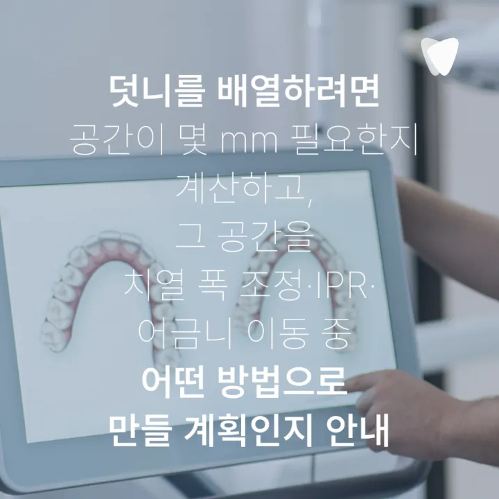 이미지 카드 · 운정 덧니 투명교정, 발치 없이 가능할까요?