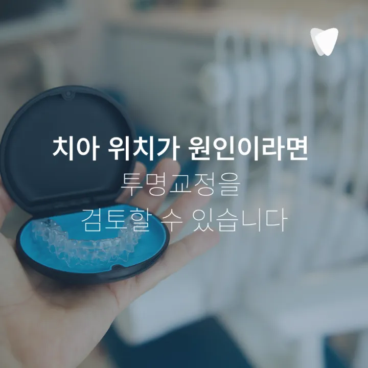 이미지 카드 · 운정 반대교합 투명교정, 가능한 경우는 따로 있습니다