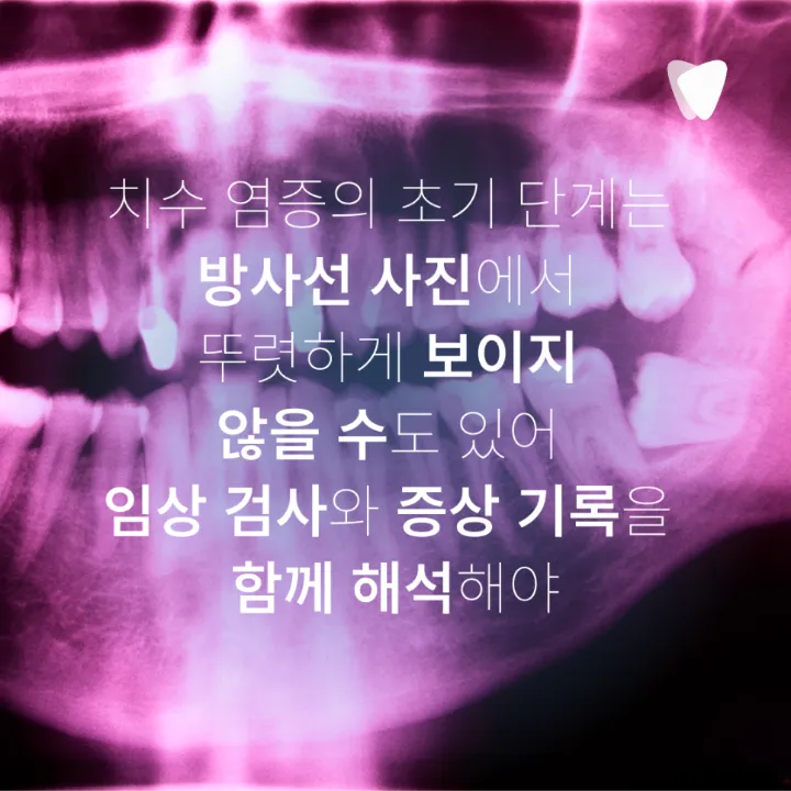이미지 카드 · 밤에 치아가 욱신거려 잠을 깬다면, 신경 염증 신호일까요