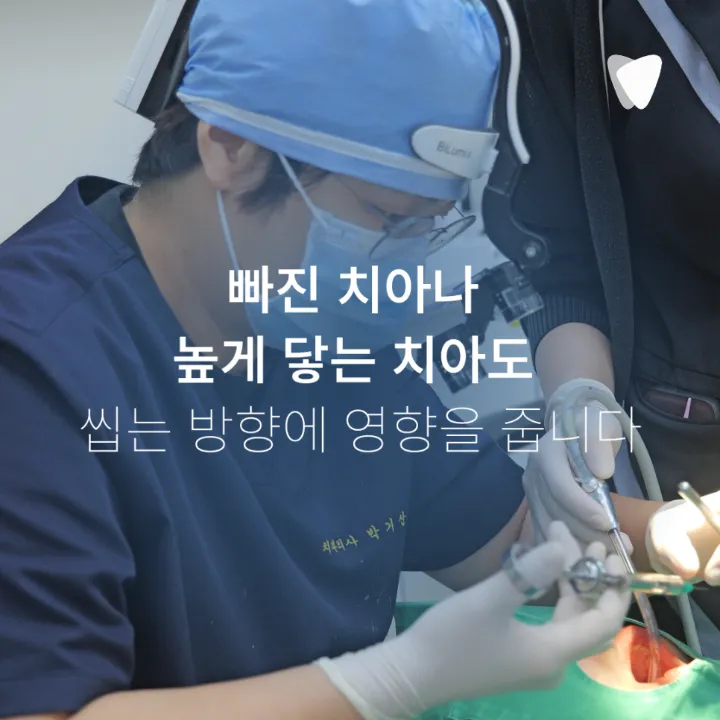 이미지 카드 · 한쪽으로만 씹게 되는 습관, 치아 문제 때문일 수 있을까요