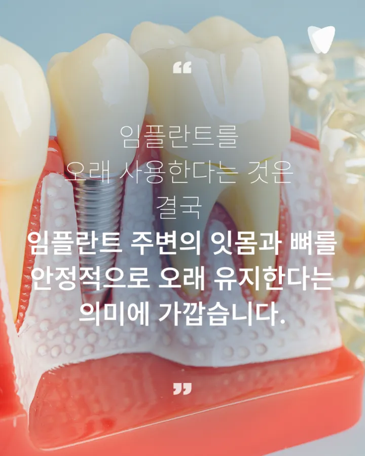 이미지 카드 · 임플란트 수명, 오래 쓰는 분들의 공통점은 무엇일까요?