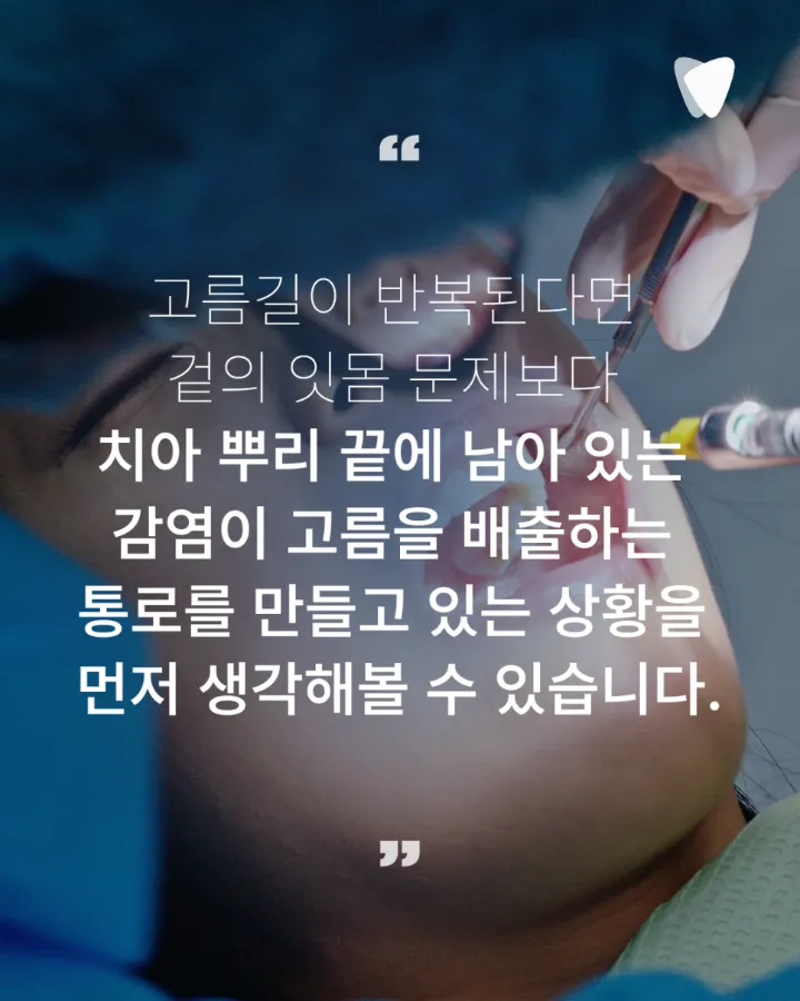 이미지 카드 · 뿌리 끝에 염증이 있는데 고름길이 반복되는 이유