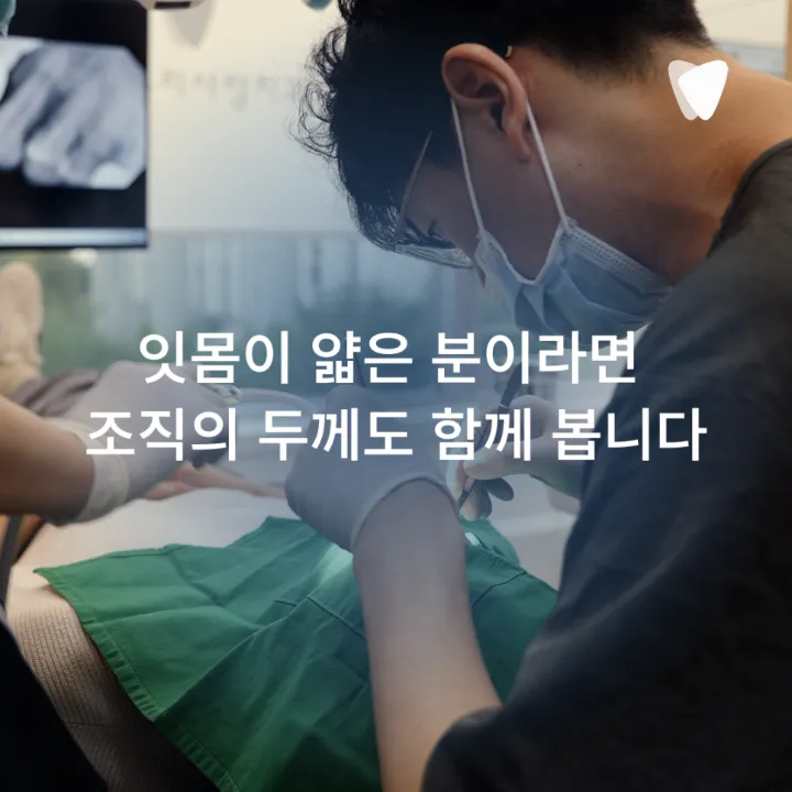 이미지 카드 · 앞니 임플란트, 잇몸 라인까지 봐야 하는 이유