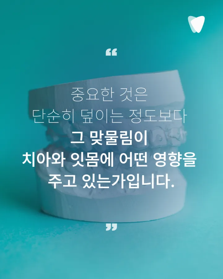 이미지 카드 · 과개교합 투명교정, 앞니가 깊게 물릴 때 무엇을 확인할까요?