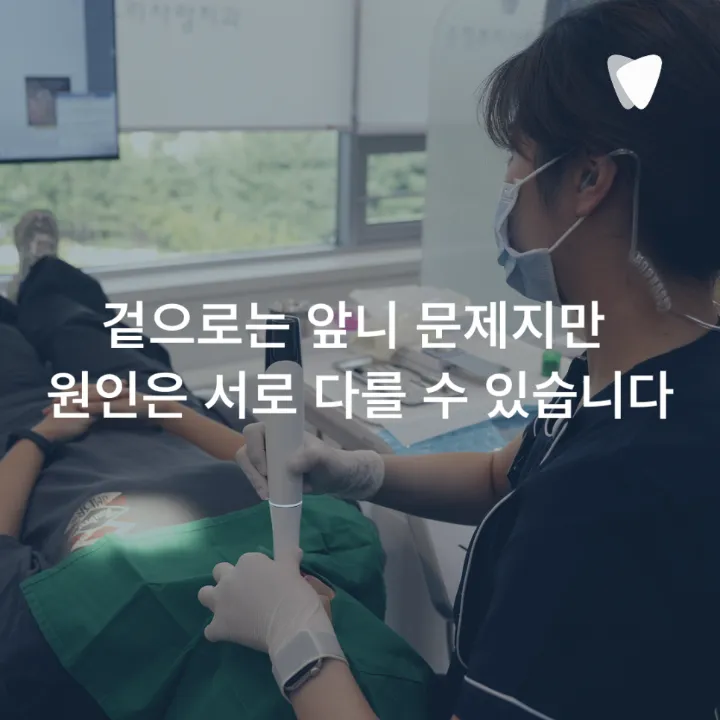 이미지 카드 · 과개교합 투명교정, 앞니가 깊게 물릴 때 무엇을 확인할까요?