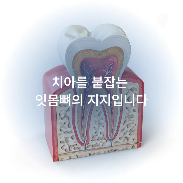이미지 카드 · 치아를 살릴 수 있을까요? 임플란트와 보존치료를 나누는 기준