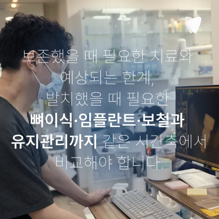 이미지 카드 · 치아를 살릴 수 있을까요? 임플란트와 보존치료를 나누는 기준
